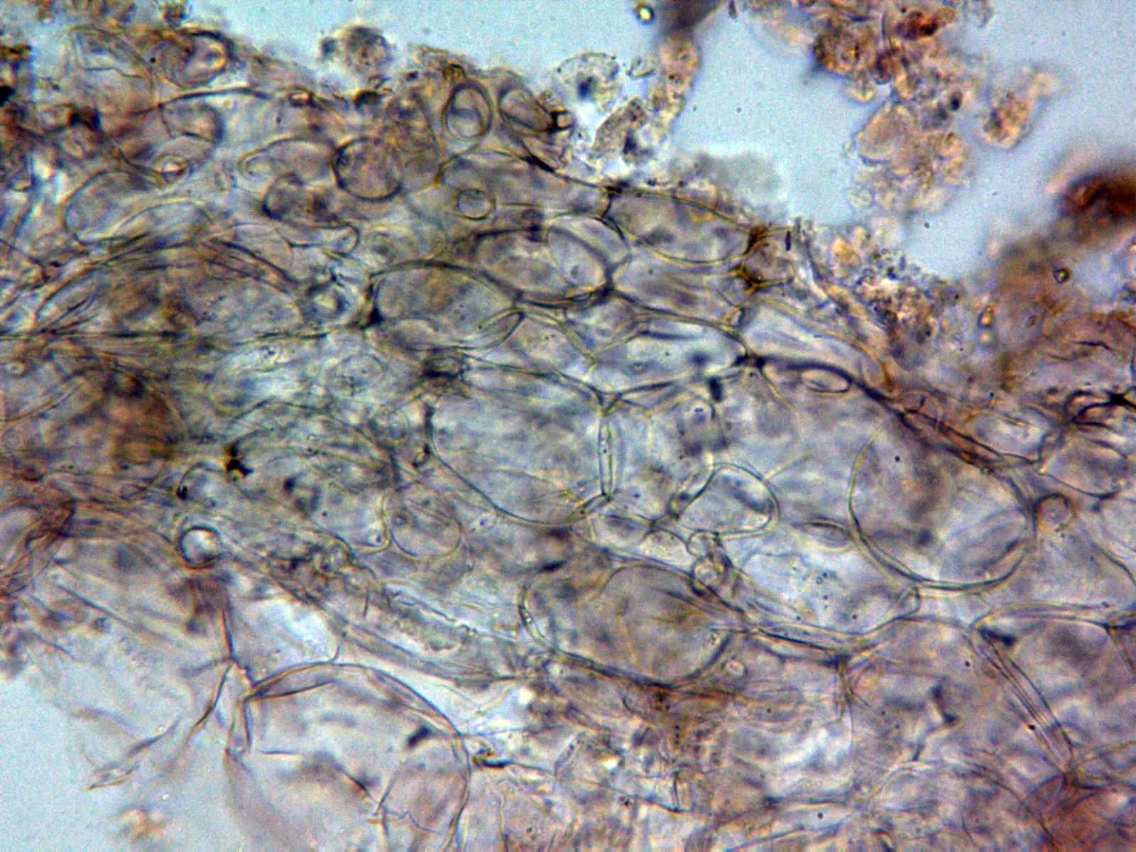Microscopía de Peziza saniosa - 10 - Excípulo ectal x 400